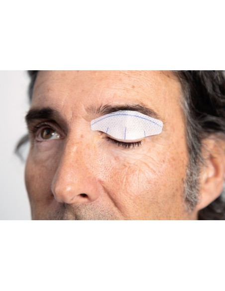 NICTAVI™ Tarsus Patch