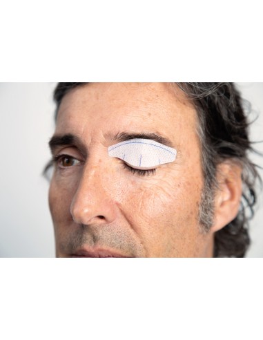 NICTAVI™ Tarsus Patch