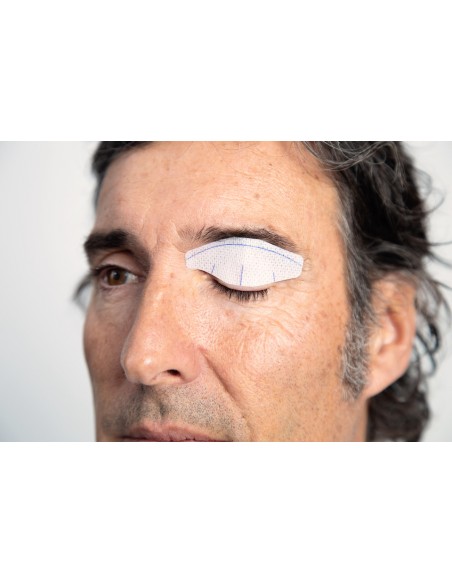 NICTAVI™ Tarsus Patch